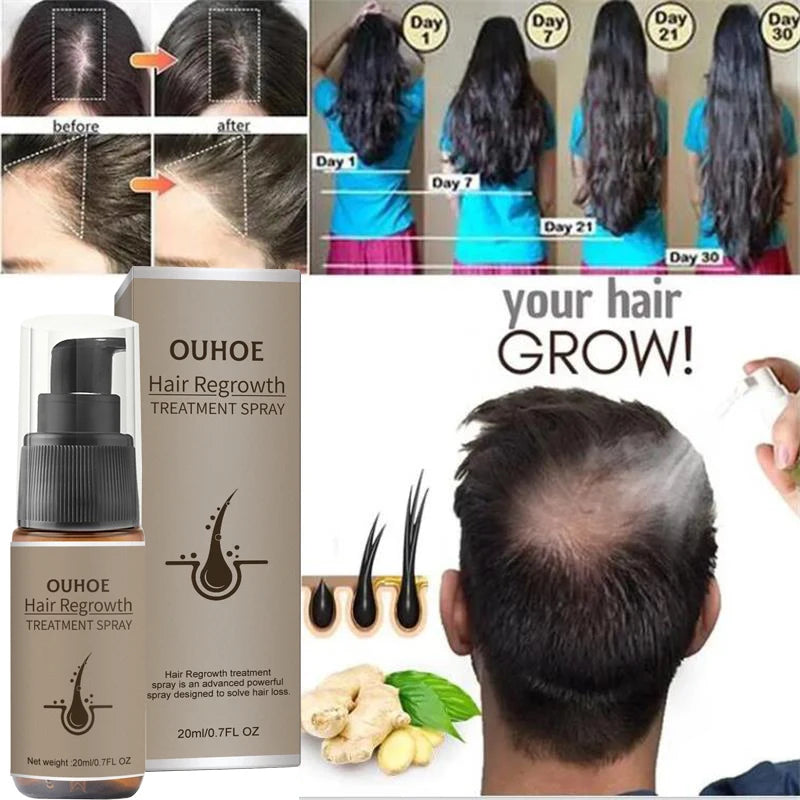 Spray de sérum de croissance des cheveux pour hommes et femmes, anti-chute de cheveux