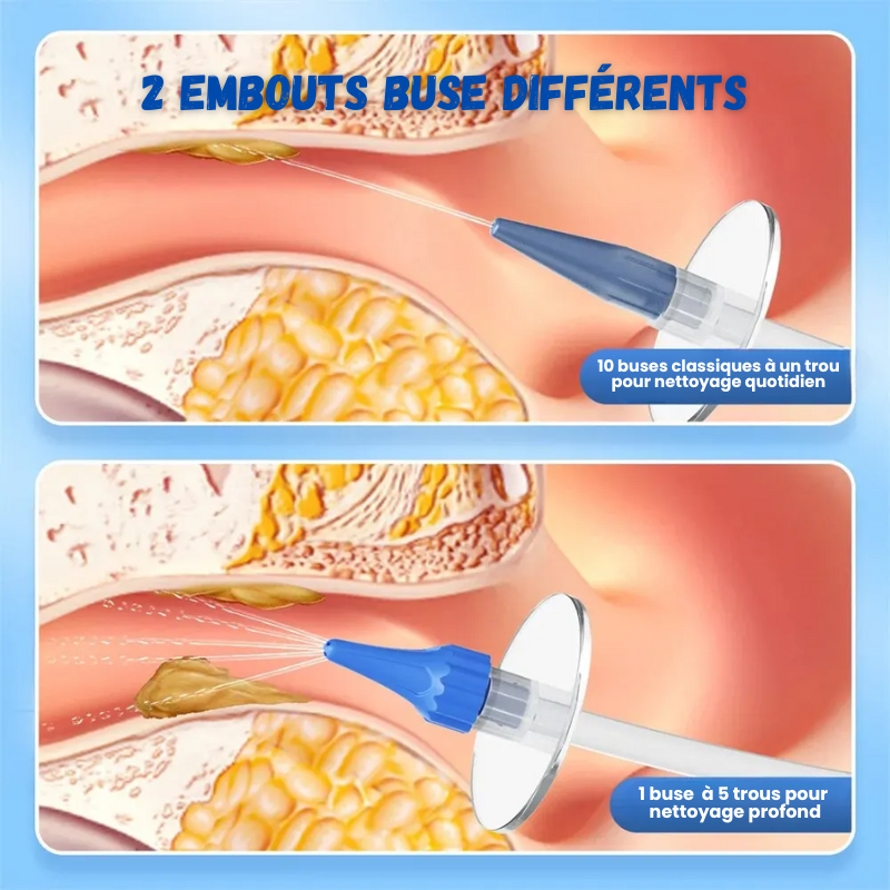 Kit Nettoyeur Irrigateur d'oreilles à eau