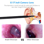 Caméra Otoscope HD pour oreilles