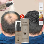 Spray de sérum de croissance des cheveux pour hommes et femmes, anti-chute de cheveux
