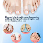 4x Séparateurs d'orteils Spécial Hallux Valgus