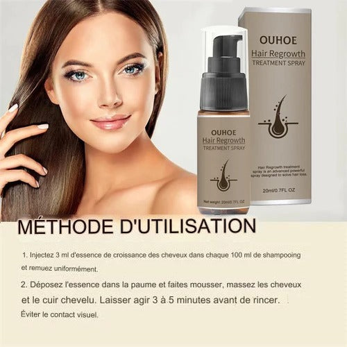 Spray de sérum de croissance des cheveux pour hommes et femmes, anti-chute de cheveux