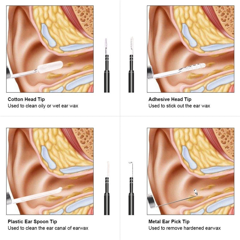 Caméra Otoscope HD pour oreilles
