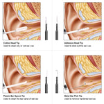 Caméra Otoscope HD pour oreilles