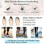 4x Séparateurs d'orteils Spécial Hallux Valgus