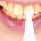 Stylo MAGIQUE dents blanches