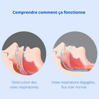 Appareil buccal anti ronflement