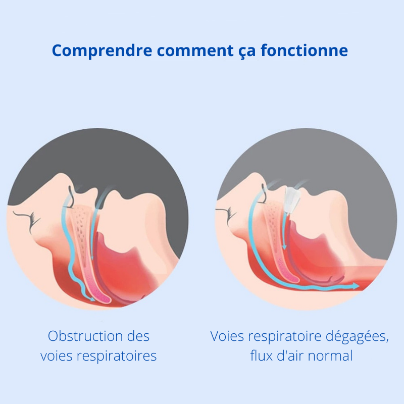 Appareil buccal anti ronflement