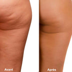 Ventouse électrique anti-cellulite
