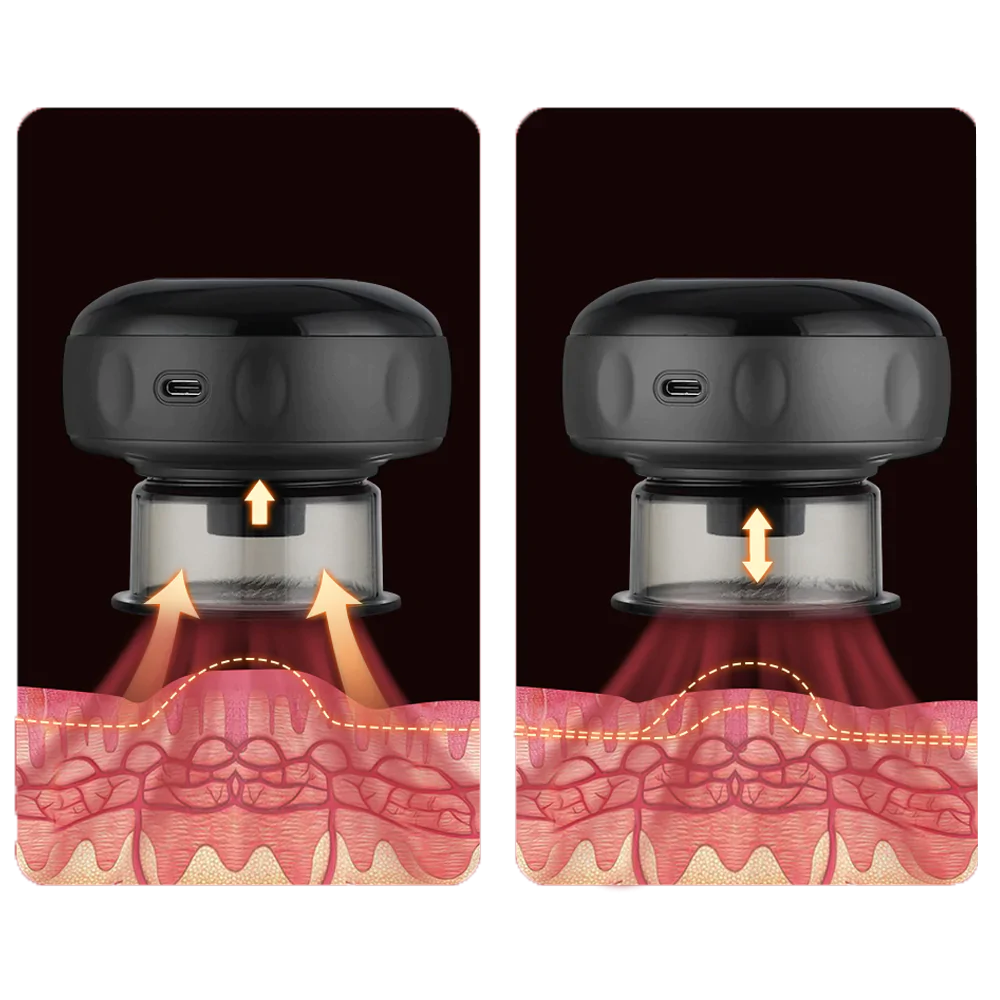 Ventouse électrique anti-cellulite